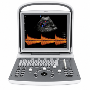 CHISON Medical Technologies Doppler Ultrasound System ECO1