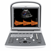 CHISON Medical Technologies Doppler Ultrasound System ECO 2