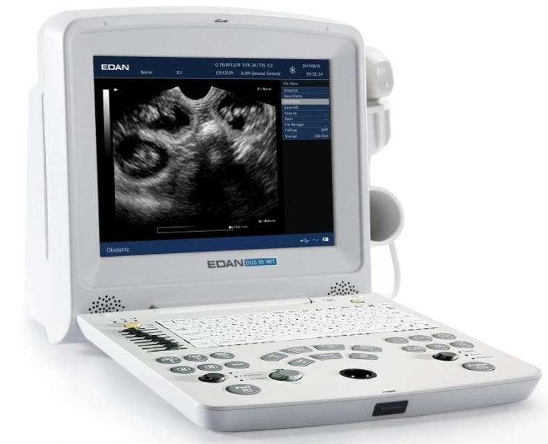 Edan Instruments Digital Ultrasonic Diagnostic Imaging System DUS 60