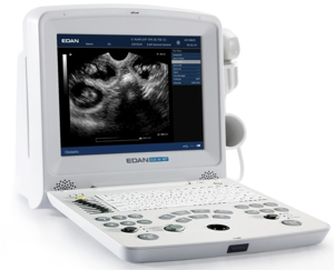 Edan Instruments Digital Ultrasonic Diagnostic Imaging System DUS 60
